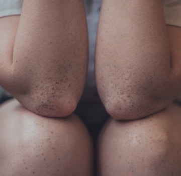 person sitting showing arms